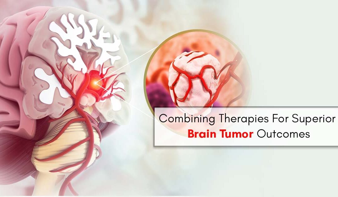 Combining Therapies For Superior Brain Tumor Outcomes