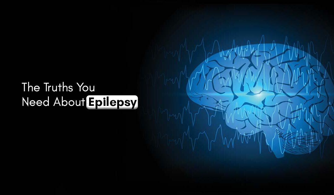 The Truths You Need About Epilepsy