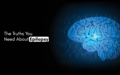 The Truths You Need About Epilepsy